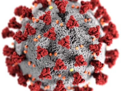 Verfahrensweise bei der Systemtherapie von Patienten mit Psoriasis während der pandemischen Phase von SARS-CoV-2 (Coronavirus)